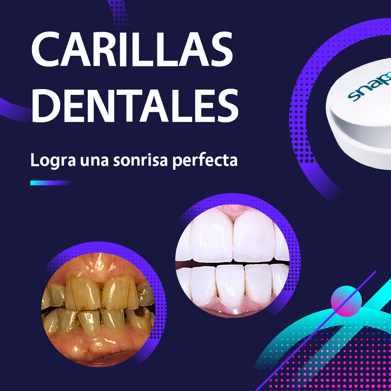 Carillas Dentales Importadas – Sonríe con Confianza